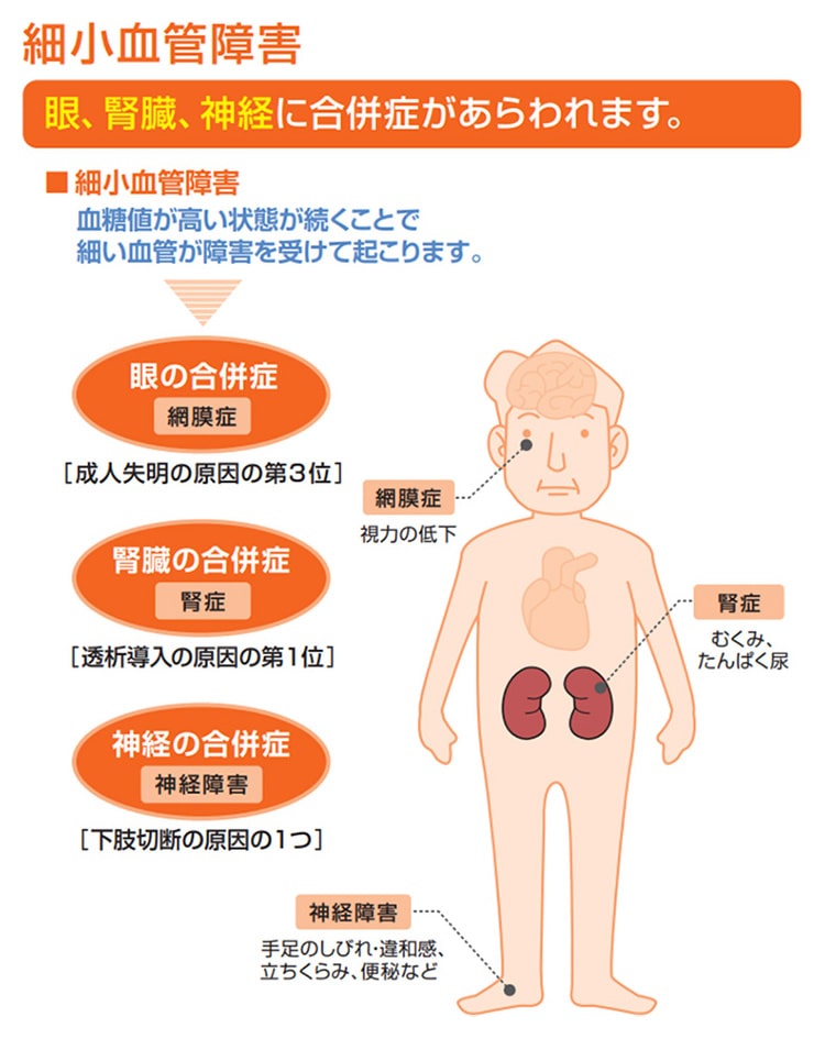 細小血管障害