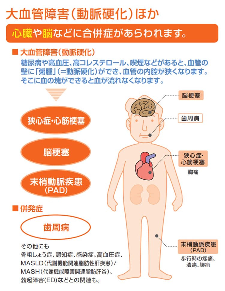 大血管障害（動脈硬化）ほか